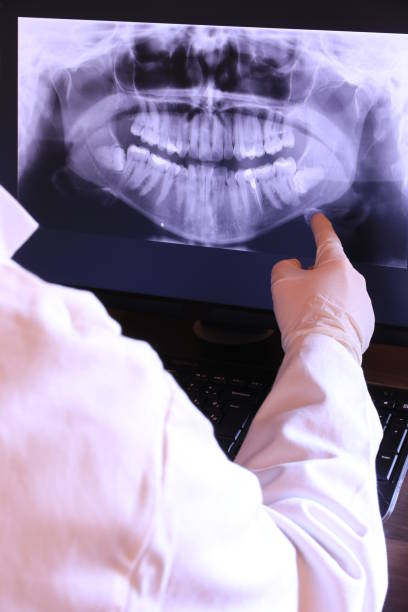 Best Emergency Denture Repair in Port Orchard, WA