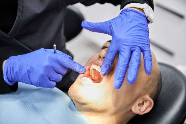 Best Knocked-Out Tooth (Avulsed Tooth) Treatment in Port Orchard, WA